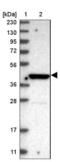 Purinergic Receptor P2X 5 antibody, NBP1-82441, Novus Biologicals, Western Blot image 
