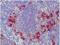 CD209 antigen-like protein B antibody, BM4011B, Origene, Immunohistochemistry frozen image 
