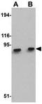 MET Transcriptional Regulator MACC1 antibody, GTX85281, GeneTex, Western Blot image 