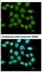 LRAT Domain Containing 1 antibody, NBP2-16424, Novus Biologicals, Immunofluorescence image 