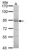 Dipeptidyl Peptidase 8 antibody, LS-B11159, Lifespan Biosciences, Western Blot image 