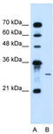 1-Acylglycerol-3-Phosphate O-Acyltransferase 2 antibody, TA336107, Origene, Western Blot image 
