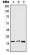 Dual Specificity Phosphatase 14 antibody, LS-C353310, Lifespan Biosciences, Western Blot image 