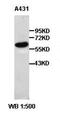 Keratin 5 antibody, orb77160, Biorbyt, Western Blot image 