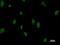Probable ATP-dependent RNA helicase DDX5 antibody, LS-C342498, Lifespan Biosciences, Immunofluorescence image 