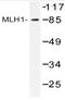 MutL Homolog 1 antibody, AP20490PU-N, Origene, Western Blot image 