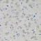 Adenosine Monophosphate Deaminase 1 antibody, 23-246, ProSci, Immunohistochemistry paraffin image 