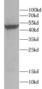 1,25-dihydroxyvitamin D(3) 24-hydroxylase, mitochondrial antibody, FNab10704, FineTest, Western Blot image 