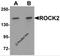 Rho Associated Coiled-Coil Containing Protein Kinase 2 antibody, 6297, ProSci Inc, Western Blot image 