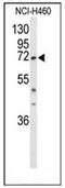 DEAD-Box Helicase 17 antibody, AP51217PU-N, Origene, Western Blot image 