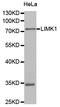 LIM Domain Kinase 1 antibody, STJ110989, St John