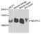 NADH:Ubiquinone Oxidoreductase Subunit A1 antibody, A8326, ABclonal Technology, Western Blot image 