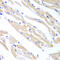 SS-A antibody, 15-060, ProSci, Immunohistochemistry paraffin image 