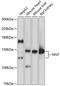 Nicotinamide Nucleotide Transhydrogenase antibody, 19-414, ProSci, Western Blot image 