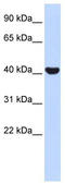 Nuclear Receptor Subfamily 2 Group E Member 1 antibody, TA329898, Origene, Western Blot image 