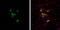 Coronin 1A antibody, GTX106424, GeneTex, Immunocytochemistry image 
