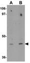 Homeobox protein DBX1 antibody, GTX32028, GeneTex, Western Blot image 