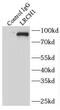Leucine Rich Repeats And Calponin Homology Domain Containing 1 antibody, FNab04839, FineTest, Immunoprecipitation image 