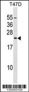 Eukaryotic translation initiation factor 3 subunit K antibody, 58-722, ProSci, Western Blot image 