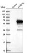 SH3 Binding Domain Protein 5 Like antibody, NBP1-81381, Novus Biologicals, Western Blot image 