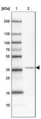 Coiled-Coil Domain Containing 113 antibody, NBP2-14443, Novus Biologicals, Western Blot image 