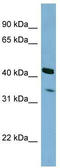 Peroxisomal Biogenesis Factor 26 antibody, TA344950, Origene, Western Blot image 