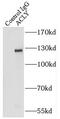 ATP Citrate Lyase antibody, FNab00687, FineTest, Immunoprecipitation image 