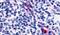 C-X-C Motif Chemokine Receptor 6 antibody, PA5-33461, Invitrogen Antibodies, Immunohistochemistry frozen image 