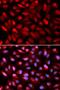 Poly(RC) Binding Protein 2 antibody, LS-B13379, Lifespan Biosciences, Immunofluorescence image 