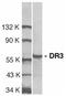 TNF Receptor Superfamily Member 25 antibody, SP1165P, Origene, Western Blot image 