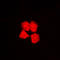 Protein Kinase N1 antibody, LS-B13584, Lifespan Biosciences, Immunofluorescence image 