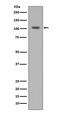 Hypoxia-inducible factor 1-alpha antibody, M00013-3, Boster Biological Technology, Western Blot image 