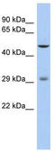 Ladybird Homeobox 1 antibody, TA331177, Origene, Western Blot image 