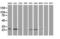 Caseinolytic Mitochondrial Matrix Peptidase Proteolytic Subunit antibody, LS-C337161, Lifespan Biosciences, Western Blot image 