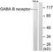 Gamma-aminobutyric acid type B receptor subunit 1 antibody, TA313903, Origene, Western Blot image 