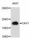 Caveolin 1 antibody, STJ112674, St John