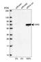 Tyrosyl-TRNA Synthetase antibody, HPA018954, Atlas Antibodies, Western Blot image 