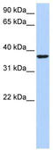 SWI/SNF-related matrix-associated actin-dependent regulator of chromatin subfamily E member 1-related antibody, TA339127, Origene, Western Blot image 