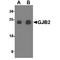 Gap Junction Protein Beta 2 antibody, TA349120, Origene, Western Blot image 