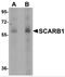 Scavenger Receptor Class B Member 1 antibody, 5193, ProSci Inc, Western Blot image 