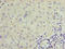 Transient Receptor Potential Cation Channel Subfamily M Member 2 antibody, LS-C395825, Lifespan Biosciences, Immunohistochemistry paraffin image 