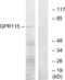 Adhesion G Protein-Coupled Receptor F4 antibody, abx015296, Abbexa, Western Blot image 