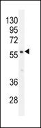 Calcium/calmodulin-dependent 3 ,5 -cyclic nucleotide phosphodiesterase 1B antibody, 56-074, ProSci, Western Blot image 