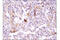 ATP Binding Cassette Subfamily C Member 1 antibody, 72202S, Cell Signaling Technology, Immunohistochemistry paraffin image 