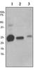 Complement C1q C Chain antibody, GTX62147, GeneTex, Western Blot image 