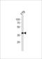 SIX Homeobox 3 antibody, 58-280, ProSci, Western Blot image 
