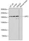 UPF2 Regulator Of Nonsense Mediated MRNA Decay antibody, GTX65954, GeneTex, Western Blot image 