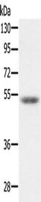 Mitochondrial-processing peptidase subunit beta antibody, TA350292, Origene, Western Blot image 