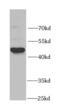 Integrin-linked protein kinase antibody, FNab04289, FineTest, Western Blot image 