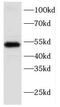 Keratin-17 antibody, FNab02202, FineTest, Western Blot image 